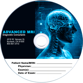 Printed Disc for MRI facility